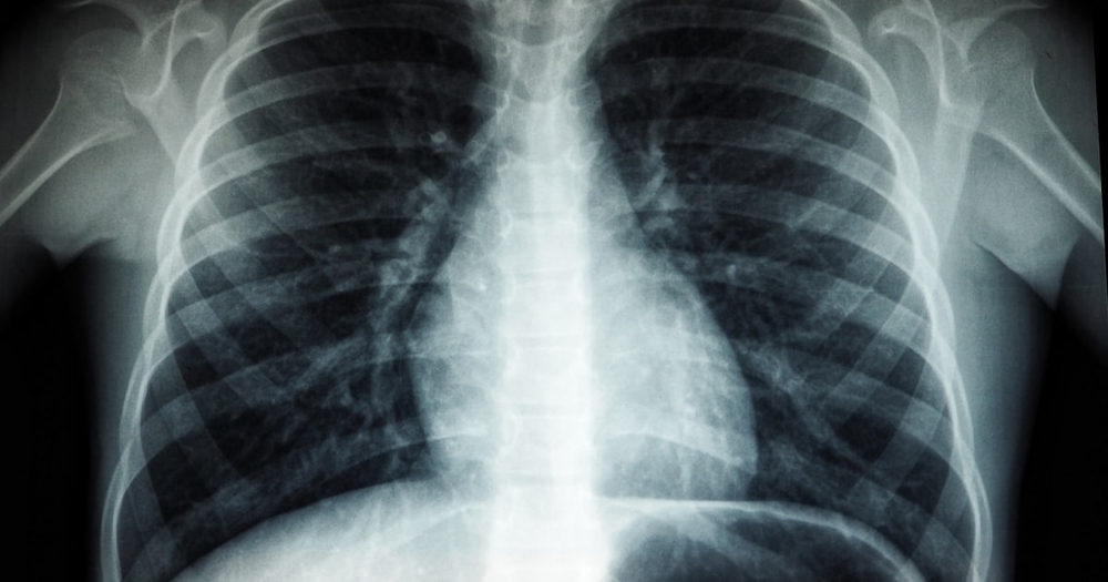 img of Incident Report: Adversarial Attack on AI Diagnostic System at NHS Trust